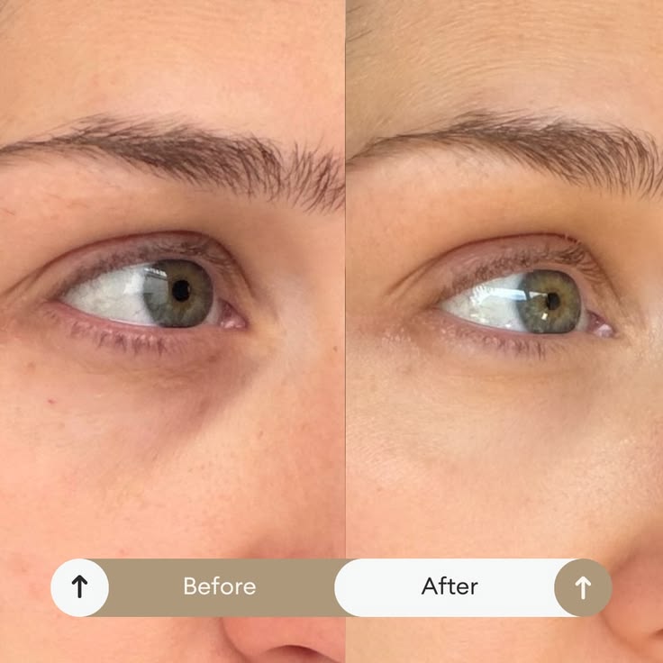 SkinBright Organic Eye Roller